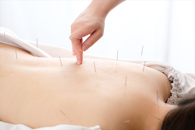 ぎっくり腰に対する鍼灸治療の効果とは？