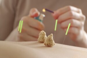 腰痛の鍼灸治療は医療控除の対象？