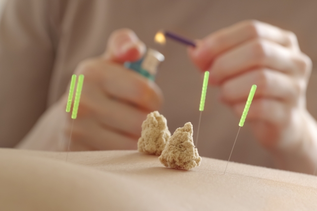 腰痛の鍼灸治療は医療控除の対象?